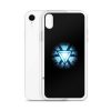 Artificial Heart iPhone Clear Case - Image 6
